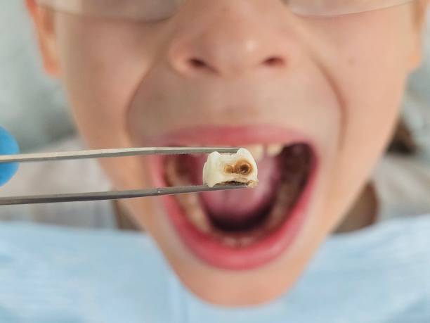 Best Emergency Treatment for Toothache in West Rancho Dominguez, CA